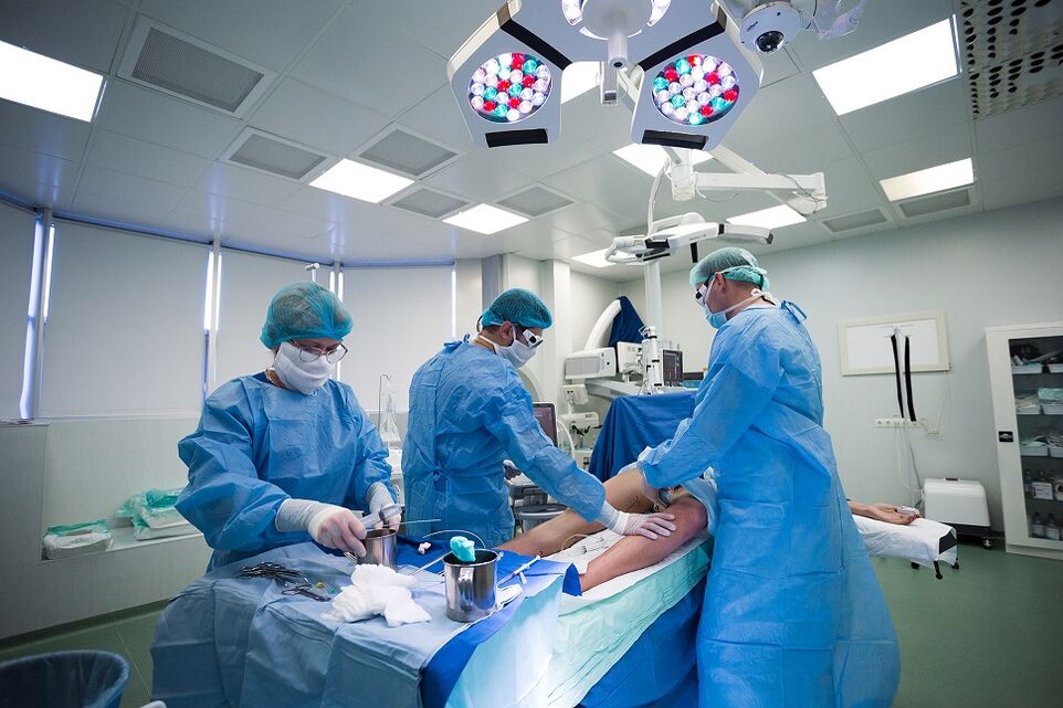 Tratamento de varices